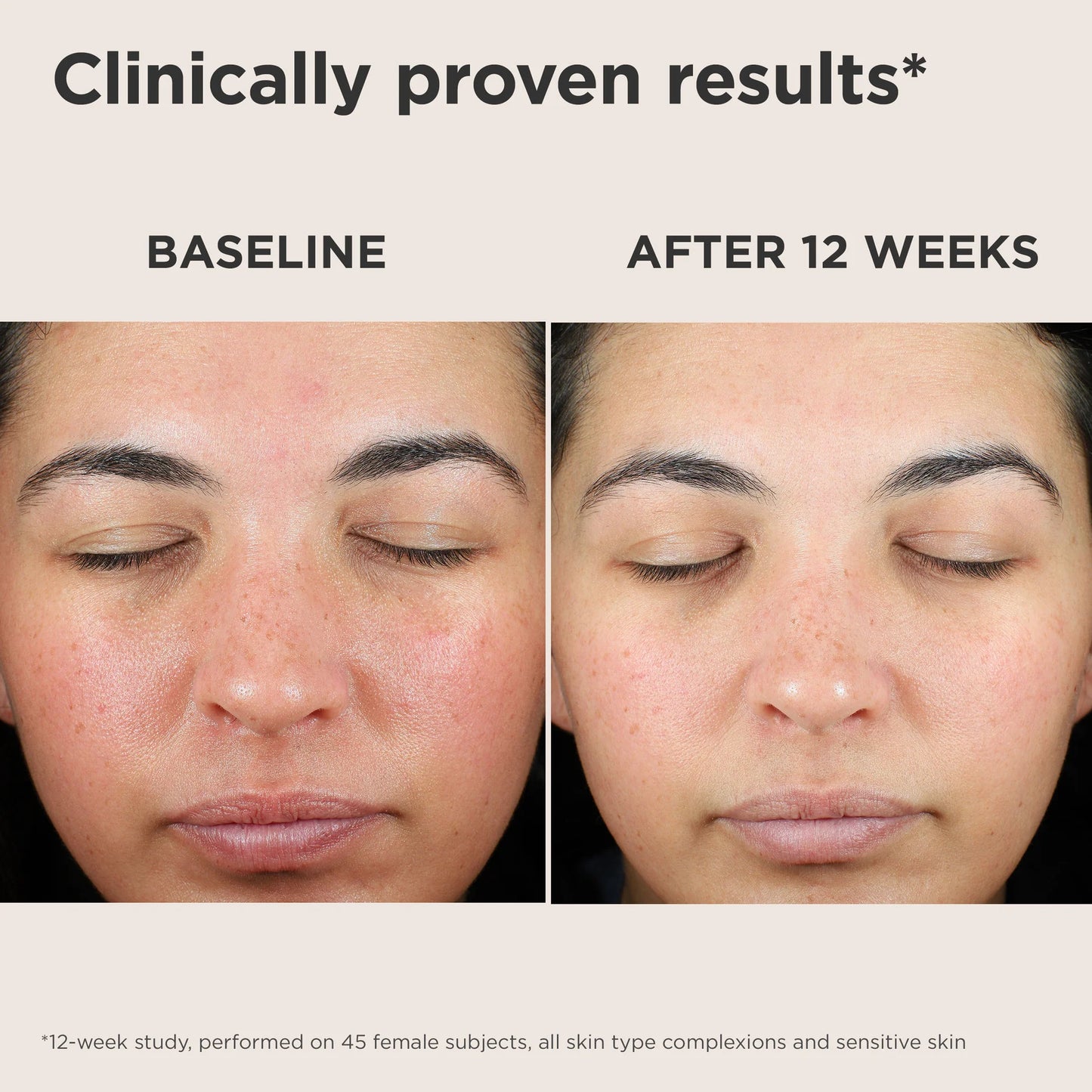 EltaMD UV Skin Recovery Red Color Correcting Green Tint Broad Spectrum SPF 50