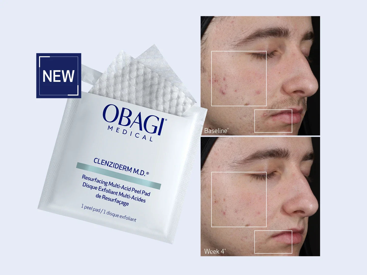 CLENZIDERM M.D.® Resurfacing Multi-Acid Peel Pads