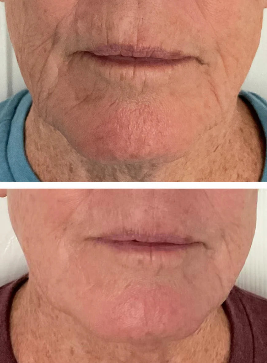 INVO Aesthetics Rejuvenating Complex (Price: $210 + tax
If purchased at the studio or by emailing us directly, you’ll receive it for $210 + tax)