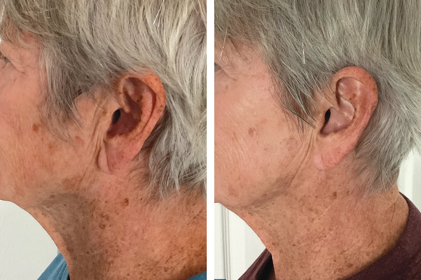 INVO Aesthetics Rejuvenating Complex (Price: $210 + tax
If purchased at the studio or by emailing us directly, you’ll receive it for $210 + tax)