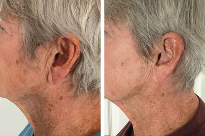 INVO Aesthetics Rejuvenating Complex (Price: $210 + tax
If purchased at the studio or by emailing us directly, you’ll receive it for $210 + tax)