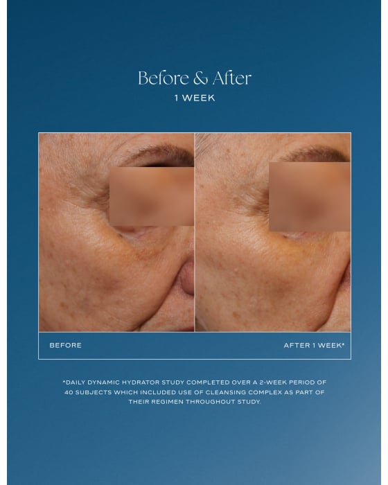 iS Clinical Daily Dynamic Hydrator